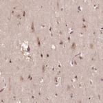 TMX2 Antibody in Immunohistochemistry (Paraffin) (IHC (P))
