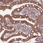 TMX2 Antibody in Immunohistochemistry (Paraffin) (IHC (P))