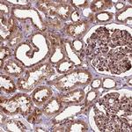 TMX2 Antibody in Immunohistochemistry (Paraffin) (IHC (P))