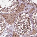 TMX2 Antibody in Immunohistochemistry (Paraffin) (IHC (P))