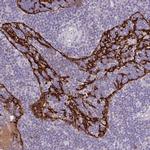 MARCO Antibody in Immunohistochemistry (IHC)