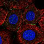 SNIP Polyclonal Antibody