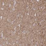 SNIP Antibody in Immunohistochemistry (Paraffin) (IHC (P))