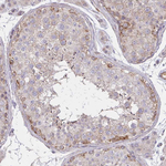 SNIP Antibody in Immunohistochemistry (Paraffin) (IHC (P))