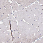 SNIP Antibody in Immunohistochemistry (Paraffin) (IHC (P))