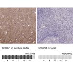 SNIP Antibody in Immunohistochemistry (IHC)