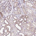 LIMCH1 Antibody in Immunohistochemistry (Paraffin) (IHC (P))