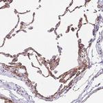 LIMCH1 Antibody in Immunohistochemistry (Paraffin) (IHC (P))