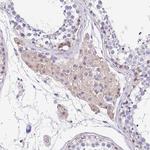 LIMCH1 Antibody in Immunohistochemistry (Paraffin) (IHC (P))