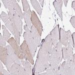 GOLGA5 Antibody in Immunohistochemistry (IHC)