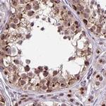 GOLGA5 Antibody in Immunohistochemistry (IHC)