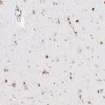 RIAM Antibody in Immunohistochemistry (Paraffin) (IHC (P))