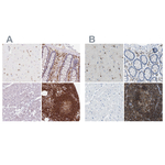 RIAM Antibody in Immunohistochemistry (Paraffin) (IHC (P))