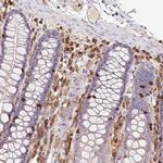RIAM Antibody in Immunohistochemistry (Paraffin) (IHC (P))
