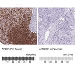 RIAM Antibody in Immunohistochemistry (IHC)