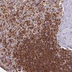RIAM Antibody in Immunohistochemistry (IHC)
