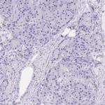 RIAM Antibody in Immunohistochemistry (IHC)