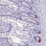 LYRM2 Antibody in Immunohistochemistry (Paraffin) (IHC (P))