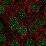 ZNF383 Polyclonal Antibody