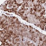 ZNF383 Antibody in Immunohistochemistry (Paraffin) (IHC (P))