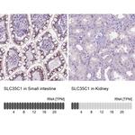 SLC35C1 Antibody in Immunohistochemistry (IHC)