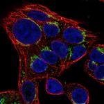 SLC35D2 Polyclonal Antibody