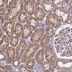 SLC35D2 Antibody in Immunohistochemistry (Paraffin) (IHC (P))