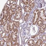 NAGPA Polyclonal Antibody