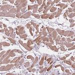 PLA2G2E Polyclonal Antibody