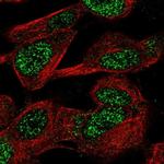 CASC10 Polyclonal Antibody