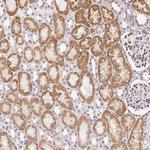 CASC10 Antibody in Immunohistochemistry (Paraffin) (IHC (P))
