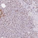 SNRPG Antibody in Immunohistochemistry (IHC)