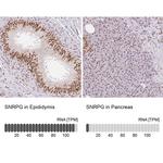 SNRPG Antibody