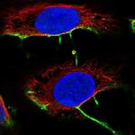 DCHS2 Polyclonal Antibody