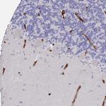 DCHS2 Antibody in Immunohistochemistry (Paraffin) (IHC (P))