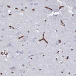 DCHS2 Antibody in Immunohistochemistry (Paraffin) (IHC (P))