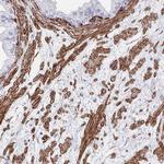 DCHS2 Antibody in Immunohistochemistry (Paraffin) (IHC (P))