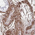 DCHS2 Antibody in Immunohistochemistry (Paraffin) (IHC (P))