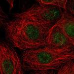 TMEM118 Polyclonal Antibody