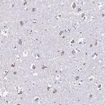 TMEM118 Antibody in Immunohistochemistry (IHC)