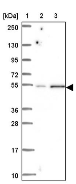 TMEM118 Antibody in Western Blot (WB)