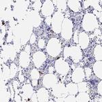 PRG3 Antibody in Immunohistochemistry (IHC)