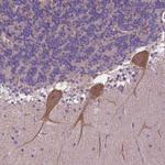 ZNF337 Polyclonal Antibody