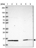NDUFS6 Antibody in Western Blot (WB)