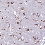 RPS16 Antibody in Immunohistochemistry (Paraffin) (IHC (P))