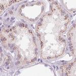 GALNT7 Antibody in Immunohistochemistry (IHC)