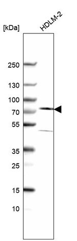 GALNT7 Antibody in Western Blot (WB)