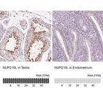 NUP210L Antibody in Immunohistochemistry (IHC)