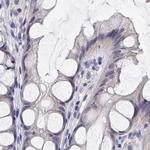 LY6D Antibody in Immunohistochemistry (IHC)