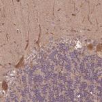 CUTA Antibody in Immunohistochemistry (Paraffin) (IHC (P))
